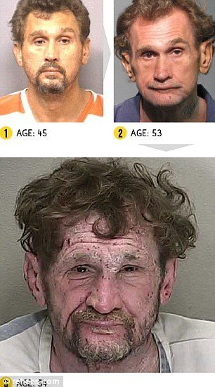 覚醒剤は怖い 薬物中毒で顔がホラー並に恐ろしくなることがわかる写真